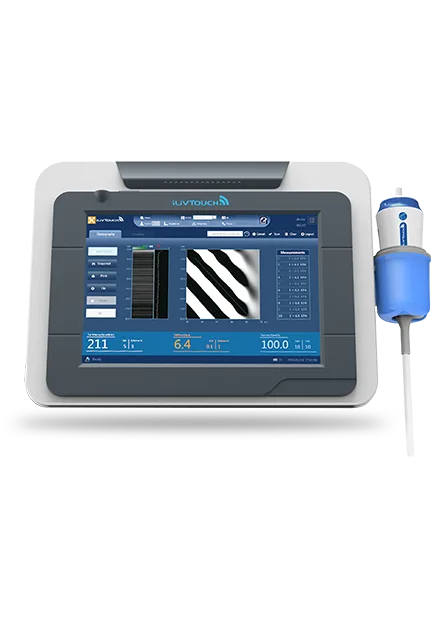 iLivTouch console showing guided liver elastography measurements